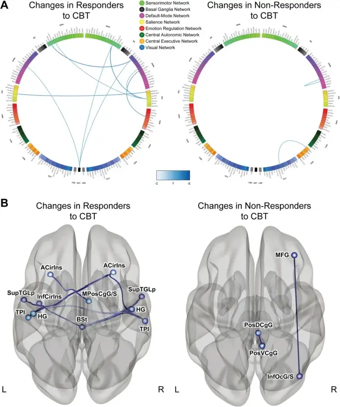 CBT for IBS & Gut Microbiome Improvement